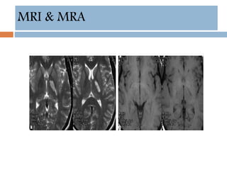 MRI & MRA
 