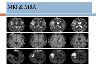 MRI & MRA
 