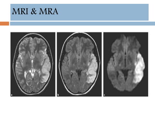 MRI & MRA
 