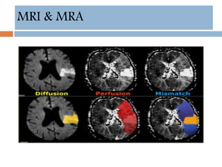 MRI & MRA
 