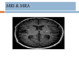 MRI & MRA
 