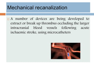 Mechanical recanalization
 A number of devices are being developed to
extract or break up thrombus occluding the larger
intracranial blood vessels following acute
ischaemic stroke, using microcatheters
 