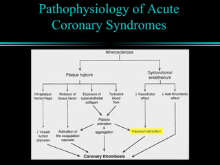 Pathophysiology of Acute
Coronary Syndromes
 
