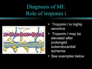 Diagnosis of MI:
Role of troponin i
♥ Troponin I is highly
sensitive
♥ Troponin I may be
elevated after
prolonged
subendocardial
ischemia
♥ See examples below
 