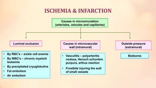 ischemia-and-infarction.ppt