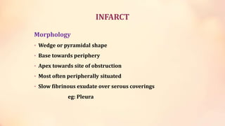 ischemia-and-infarction.ppt