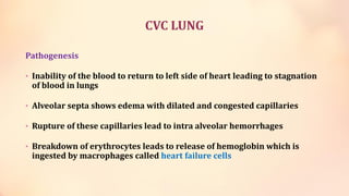 ischemia and infarction.pdf
