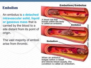 Ischemia and Infarction.pdf