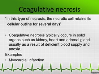 Coagulative necrosis
“In this type of necrosis, the necrotic cell retains its
cellular outline for several days”
• Coagulative necrosis typically occurs in solid
organs such as kidney, heart and adrenal gland
usually as a result of deficient blood supply and
anoxia.
Examples
• Myocardial infarction
 