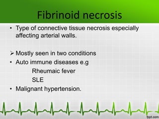 Fibrinoid necrosis
• Type of connective tissue necrosis especially
affecting arterial walls.
 Mostly seen in two conditions
• Auto immune diseases e.g
Rheumaic fever
SLE
• Malignant hypertension.
 
