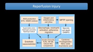 Ischemia reperfusion | PPTX