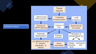 Ischemia reperfusion | PPTX