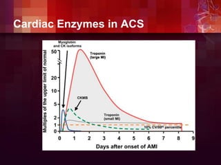 Cardiac Enzymes in ACS
 