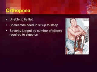 Orthopnea
• Unable to lie flat
• Sometimes need to sit up to sleep
• Severity judged by number of pillows
required to sleep on
 