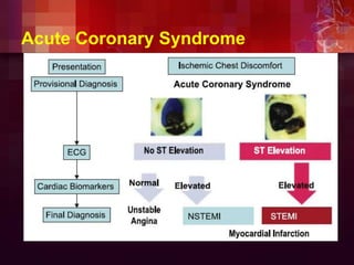Acute Coronary Syndrome
 