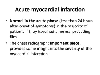 Acute myocardial infarction
• Normal in the acute phase (less than 24 hours
after onset of symptoms) in the majority of
patients if they have had a normal preceding
film.
• The chest radiograph: important piece,
provides some insight into the severity of the
myocardial infarction.
 