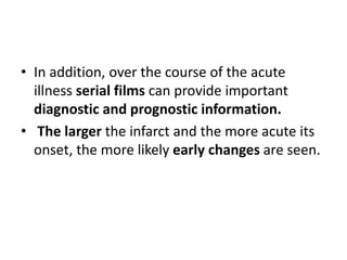 • In addition, over the course of the acute
illness serial films can provide important
diagnostic and prognostic information.
• The larger the infarct and the more acute its
onset, the more likely early changes are seen.
 