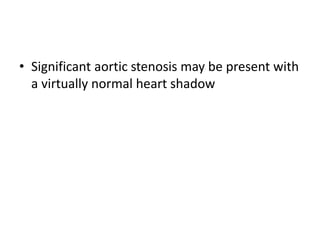• Significant aortic stenosis may be present with
a virtually normal heart shadow
 