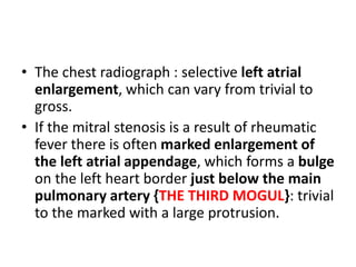 • The chest radiograph : selective left atrial
enlargement, which can vary from trivial to
gross.
• If the mitral stenosis is a result of rheumatic
fever there is often marked enlargement of
the left atrial appendage, which forms a bulge
on the left heart border just below the main
pulmonary artery {THE THIRD MOGUL}: trivial
to the marked with a large protrusion.
 
