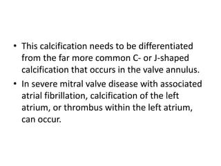 • This calcification needs to be differentiated
from the far more common C- or J-shaped
calcification that occurs in the valve annulus.
• In severe mitral valve disease with associated
atrial fibrillation, calcification of the left
atrium, or thrombus within the left atrium,
can occur.
 