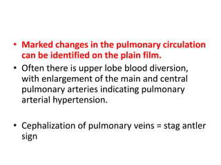 • Marked changes in the pulmonary circulation
can be identified on the plain film.
• Often there is upper lobe blood diversion,
with enlargement of the main and central
pulmonary arteries indicating pulmonary
arterial hypertension.
• Cephalization of pulmonary veins = stag antler
sign
 