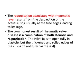 • The regurgitation associated with rheumatic
fever results from the destruction of the
actual cusps, usually at the free edges leading
to leakage.
• The commonest result of rheumatic valve
disease is a combination of both stenosis and
regurgitation. The valve fails to open fully in
diastole, but the thickened and rolled edges of
the cusps do not fully coapt (seal).
 
