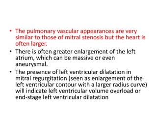 • The pulmonary vascular appearances are very
similar to those of mitral stenosis but the heart is
often larger.
• There is often greater enlargement of the left
atrium, which can be massive or even
aneurysmal.
• The presence of left ventricular dilatation in
mitral regurgitation (seen as enlargement of the
left ventricular contour with a larger radius curve)
will indicate left ventricular volume overload or
end-stage left ventricular dilatation
 