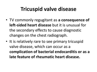 Tricuspid valve disease
• TV commonly regugitant as a consequence of
left-sided heart disease but it is unusual for
the secondary effects to cause diagnostic
changes on the chest radiograph.
• It is relatively rare to see primary tricuspid
valve disease, which can occur as a
complication of bacterial endocarditis or as a
late feature of rheumatic heart disease.
 