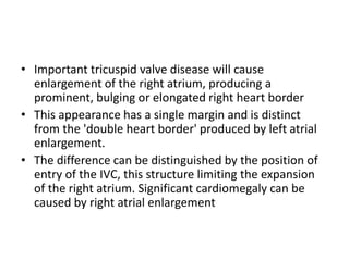 • Important tricuspid valve disease will cause
enlargement of the right atrium, producing a
prominent, bulging or elongated right heart border
• This appearance has a single margin and is distinct
from the 'double heart border' produced by left atrial
enlargement.
• The difference can be distinguished by the position of
entry of the IVC, this structure limiting the expansion
of the right atrium. Significant cardiomegaly can be
caused by right atrial enlargement
 