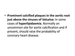 • Prominent calcified plaques in the aortic root
just above the sinuses of Valsalva: In some
cases of hyperlipidaemia. Normally an
uncommon site for aortic calcification and if
present, should raise the probability of
coronary heart disease.
 