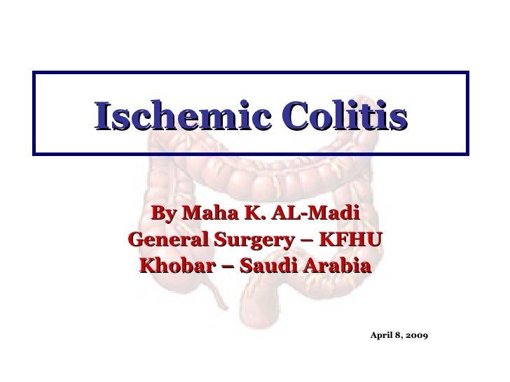 Ischemic Colitis