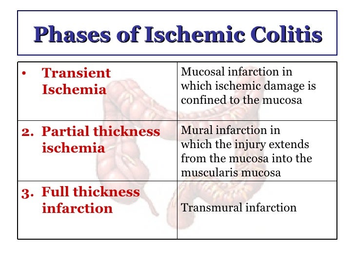 Ischemic Colitis