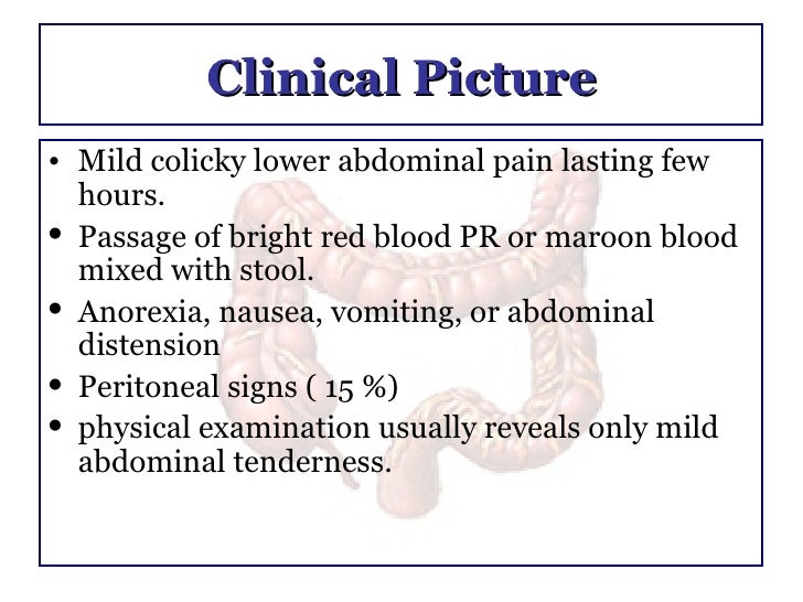Ischemic Colitis
