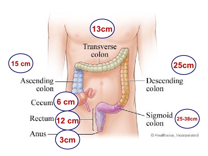 Ischemic Colitis