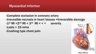 Myocardial Infartion
-Complete occlusion in coronary artery
-Irrevesible necrosis in heart tissues =Irreversible damage
-1st MI <2nd MI < 3rd MI < < < severity
-Lasts > 15 mins
-Crushing type chest pain
 
