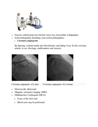  Exercise radioisotope test (nuclear stress test, myocardial scintigraphy)
 Echocardiography (including stress echocardiography):
 Coronaryangiogram
By injecting contrast media into bloodstream and taking X ray for the coronary
arteries to see blockage, malformation and stenosis.
Coronary angiogram of a man Coronary angiogram of a woman
 Intravascular ultrasound
 Magnetic resonance imaging (MRI)
 Multifunction Cardiogram (MCG)
 X-ray of the chest and
 Blood tests may be performed.
 