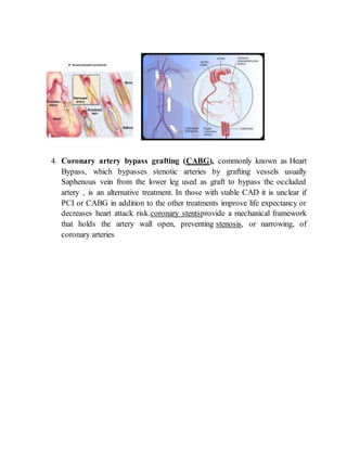4. Coronary artery bypass grafting (CABG), commonly known as Heart
Bypass, which bypasses stenotic arteries by grafting vessels usually
Saphenous vein from the lower leg used as graft to bypass the occluded
artery , is an alternative treatment. In those with stable CAD it is unclear if
PCI or CABG in addition to the other treatments improve life expectancy or
decreases heart attack risk.coronary stentsprovide a mechanical framework
that holds the artery wall open, preventing stenosis, or narrowing, of
coronary arteries
 