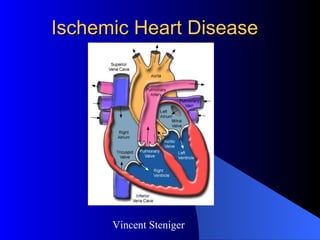 Ischemic Heart Disease Vincent Steniger 