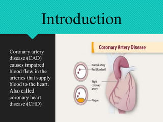 Coronary artery
disease (CAD)
causes impaired
blood flow in the
arteries that supply
blood to the heart.
Also called
coronary heart
disease (CHD)
Introduction
 