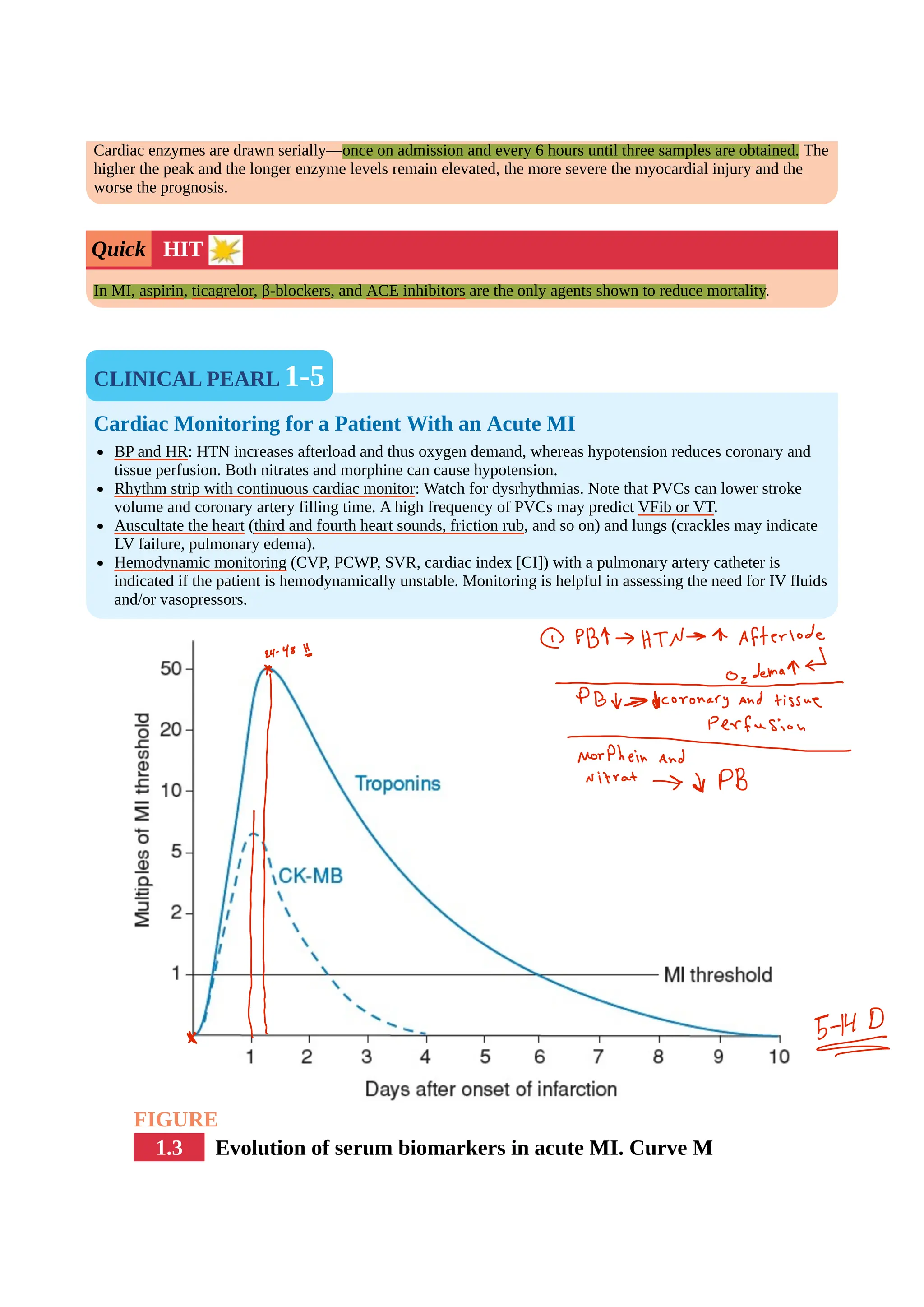 Ischemic Heart Disease - Myocardial Infarction.pdf