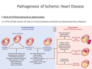 Ischemic heart disease | PPTX