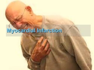 Myocardial Infarction

7

 
