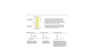 Comprehensive Overview of Ischemic Heart Disease and Acute Coronary ...