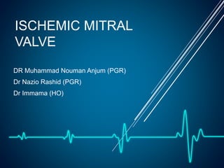 ISCHEMIC MITRAL
VALVE
DR Muhammad Nouman Anjum (PGR)
Dr Nazio Rashid (PGR)
Dr Immama (HO)
 