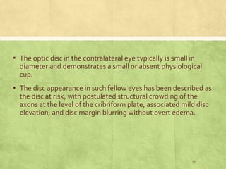 Disc At Risk Ischemic optic neuropathies | PPTX