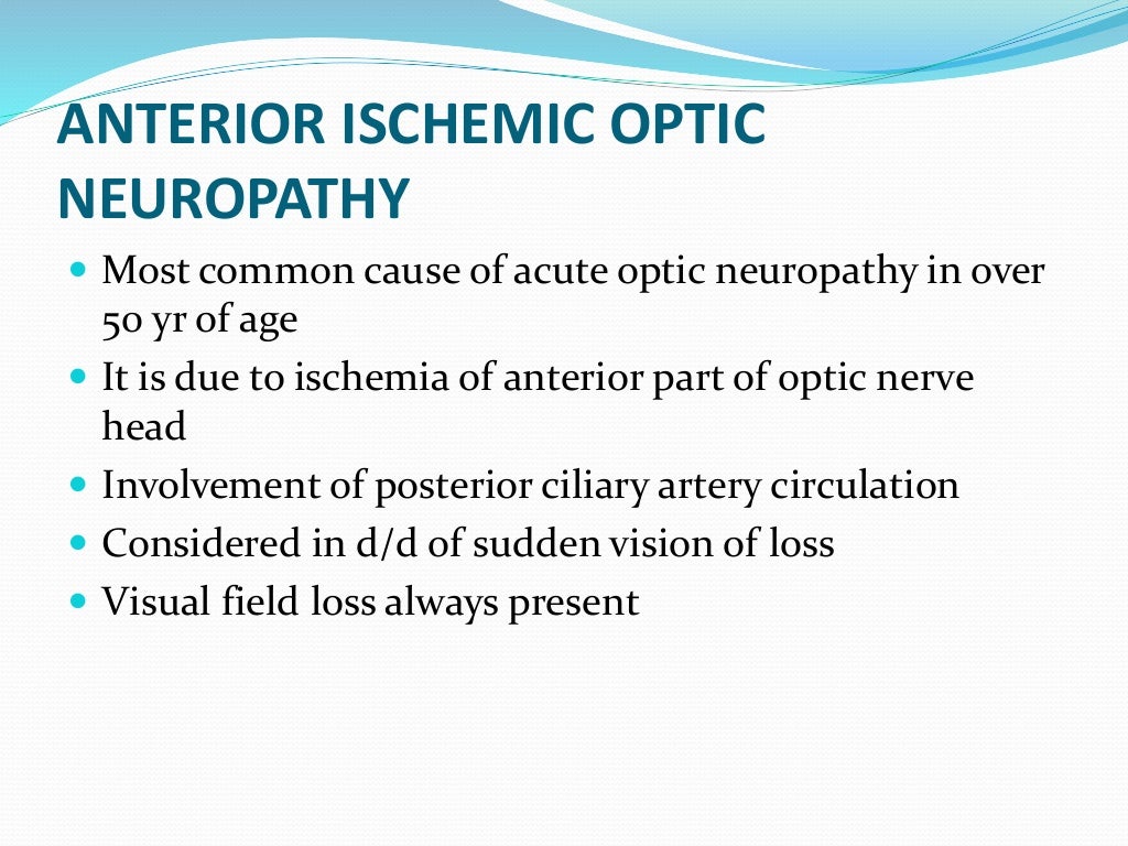 Ischemic optic neuropathy