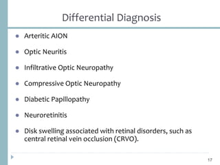 Differential Diagnosis
● Arteritic AION
● Optic Neuritis
● Infiltrative Optic Neuropathy
● Compressive Optic Neuropathy
● Diabetic Papillopathy
● Neuroretinitis
● Disk swelling associated with retinal disorders, such as
central retinal vein occlusion (CRVO).
17
 