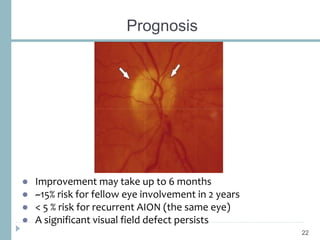 Prognosis
● Improvement may take up to 6 months
● ~15% risk for fellow eye involvement in 2 years
● < 5 % risk for recurrent AION (the same eye)
● A significant visual field defect persists
22
 