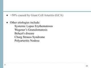 ● >50% caused by Giant Cell Arteritis (GCA)
● Other etiologies include:
Systemic Lupus Erythematosus
Wegener’s Granulomatosis
Behçet's disease
Churg Strauss Syndrome
Polyarteritis Nodosa
25
 