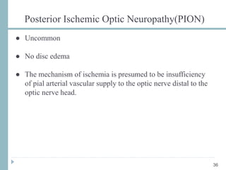 Posterior Ischemic Optic Neuropathy(PION)
● Uncommon
● No disc edema
● The mechanism of ischemia is presumed to be insufficiency
of pial arterial vascular supply to the optic nerve distal to the
optic nerve head.
36
 